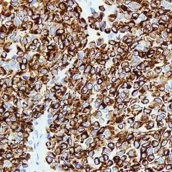 immunohistochemistry desmin test